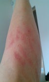 Left leg
