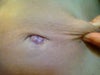 After close up
