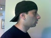 side profile before surgery