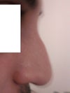 nose 1