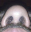 nose2