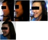 This is the left side of my face.