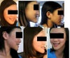 This is the right side of my face. The right side of my chin (as well as my face, actually) is larger, and it shows more when looking at the left side of my face.