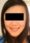 My whole face. I have a heart-shaped face (or used to, at least, when I was a kid before my chin got so big). Now, because it sticks out a lot, people sometimes comment that I look "ferocious". I also have a small cleft chin, but I'm not concerned about that.