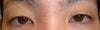 15 days after
