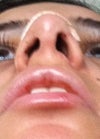 a photo of my nostrils