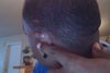 back of ear