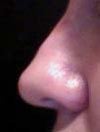 Nose from left side