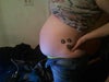 Side view of me leaning back. The diastasi is right above my belly button and going up