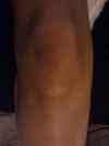 Another scar in my life immediately preceded by "Don't do that!" while riding a bike...