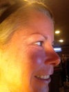 The reason I get botox! ugh!!