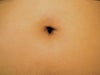 How I want it to look after surgery
