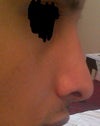 My right profile