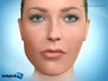 This is the closest representation of my asymmetry I found on the web