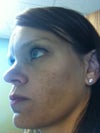 This is with make-up (I applied 3 different foundations this morning and it's noon now)