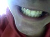 my smile