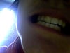 my teeth