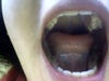 my jaw