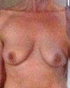 before op
