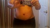 Me now - Post TT - Almost 4 mos