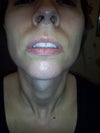 Area on both sides of nose looks shadowed