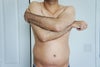 pre-op day