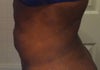 20 days Post Side  (Lumping & hardness)