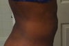 20 days Post Side (Lumping & hardness)