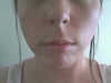 Font view ( can kinda see the wrinkles im referring to in my chin)