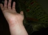 arm