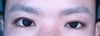 left eye higher than right