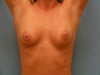 pre