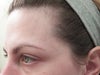 Streaks on left temple/forehead area.