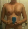 this is one week post-op