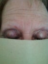 eye brows