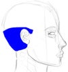 The blue area is where the excessive sweating occurs.