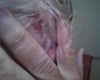 staples left in
