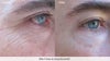 Nerium before and after