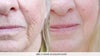 before and after 2, from their website