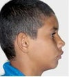 this is similar to my case, what are all the causes?
