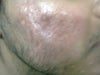 thats the right side cheek