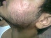 thats the left side cheek