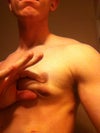 POST SURGERY 5 weeks