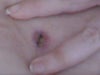 navel yellowish inside....