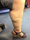 Left Calve