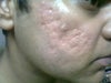right cheek
