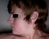 Profile view that was not affected by trauma