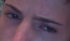 desired squinting side after