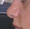 Before operation
