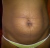 my tummy after one baby